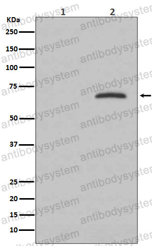 Anti-Phospho-PXN/Paxillin (Y118) Antibody (R1X23)