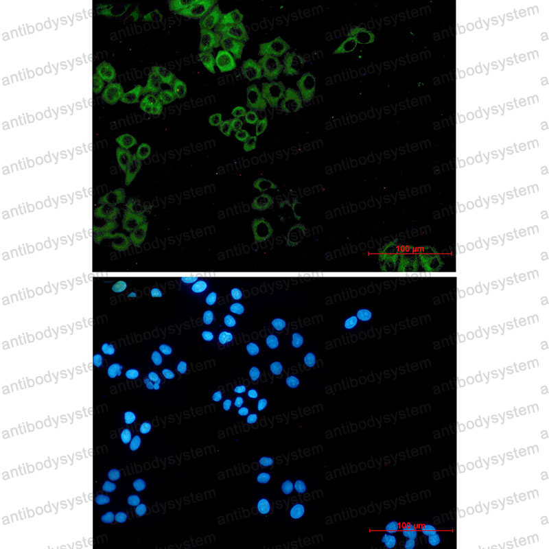 Anti-PXN Antibody (R1X25)