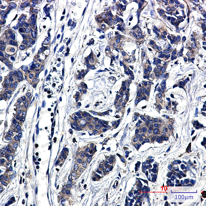 Anti-PXN Antibody (R1X24)