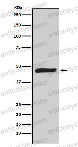 Anti-MAPKAPK2 Antibody (R1X26)