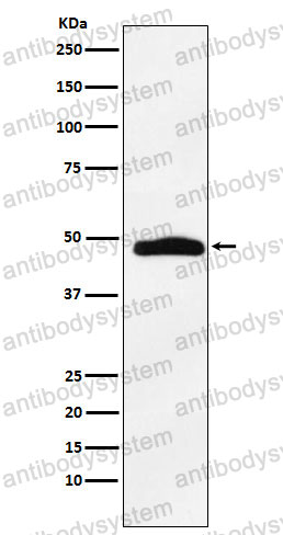 Anti-MAPKAPK2 Antibody (R1X27)