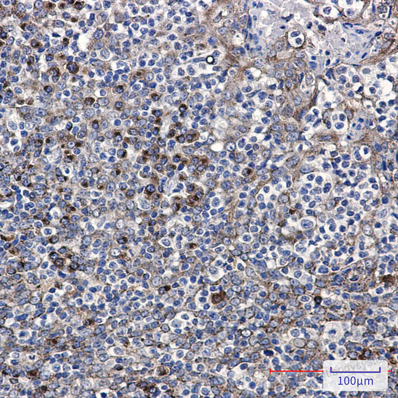Anti-LMAN1 Antibody (R1X31)