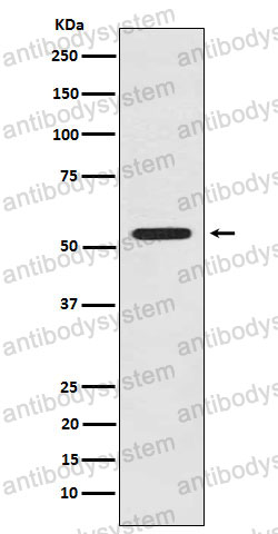 Anti-LMAN1 Antibody (R1X30)