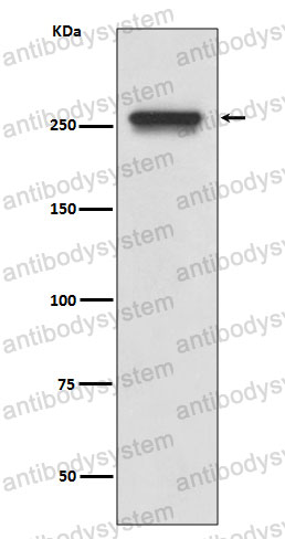 Anti-FASN Antibody (R1X32)