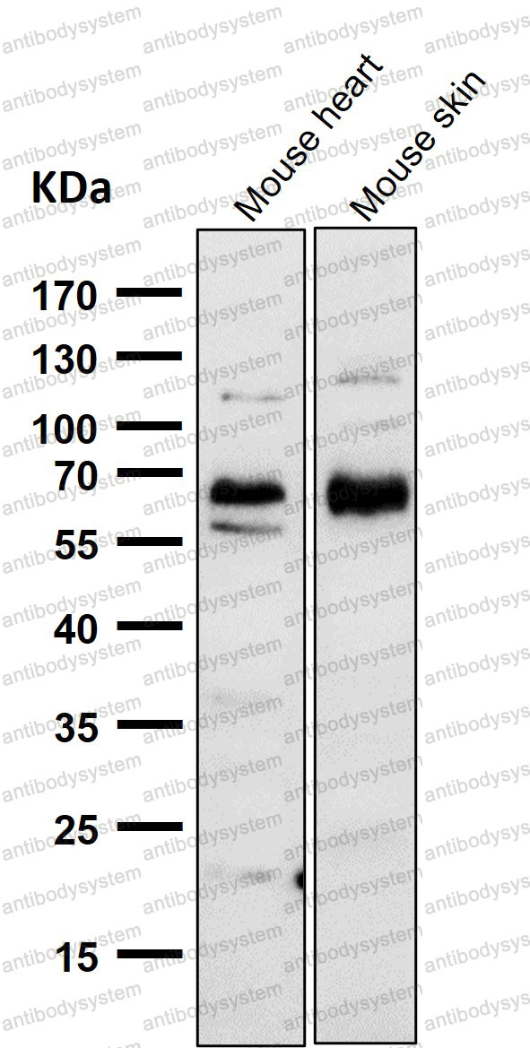 Anti-CDK8 Antibody (R1X33)