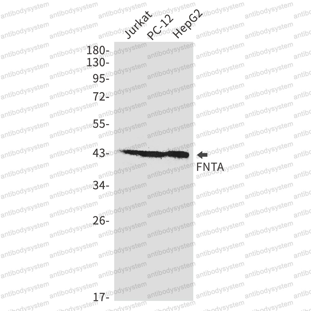 Anti-FNTA Antibody (R1X34)