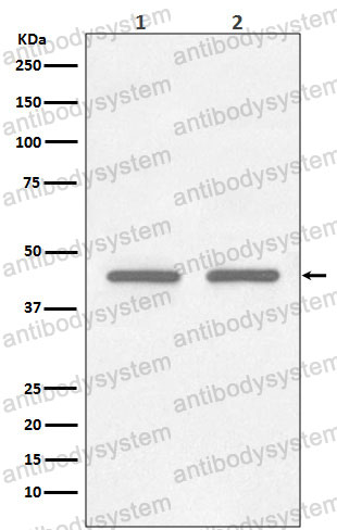 Anti-FNTB Antibody (R1X35)