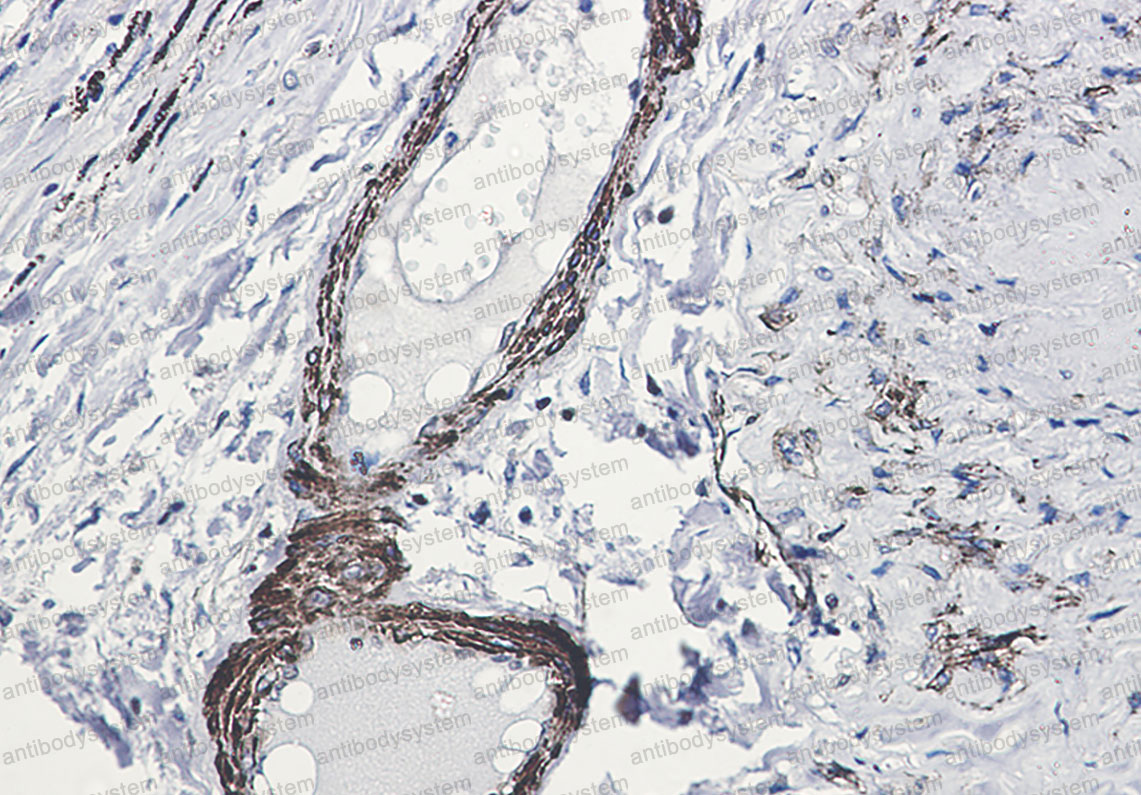 Anti-Phospho-ARRB1 (Ser412) Antibody (R1X37)