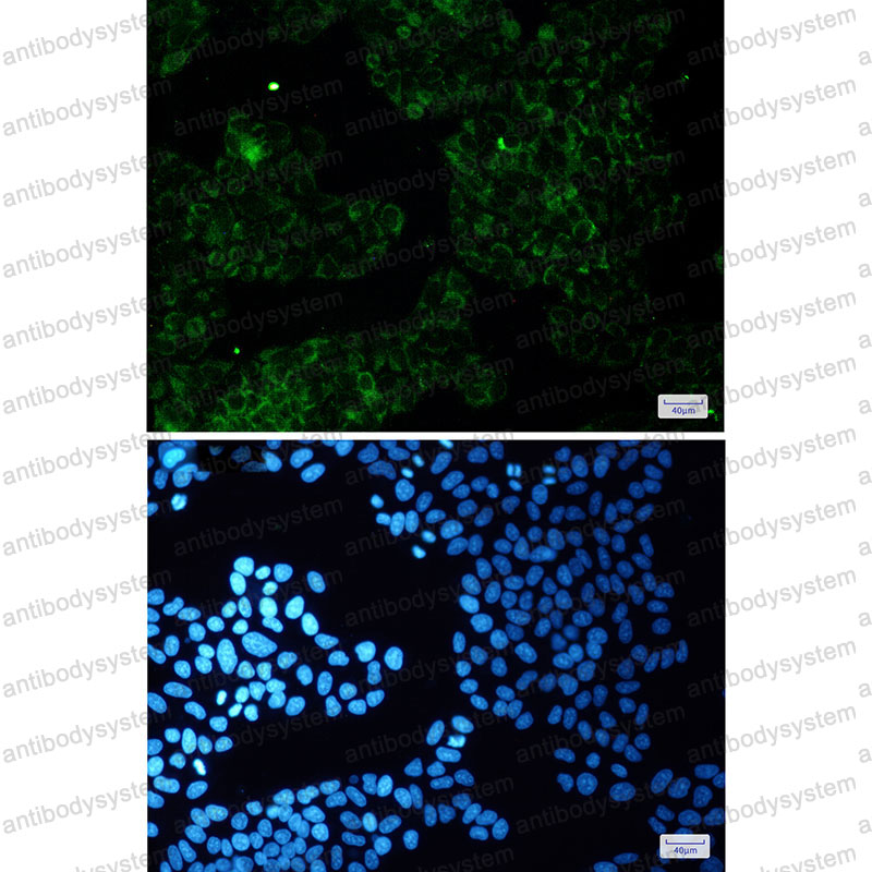 Anti-ALDH7A1 Antibody (R1X39)