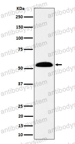 Anti-ALDH7A1 Antibody (R1X38)