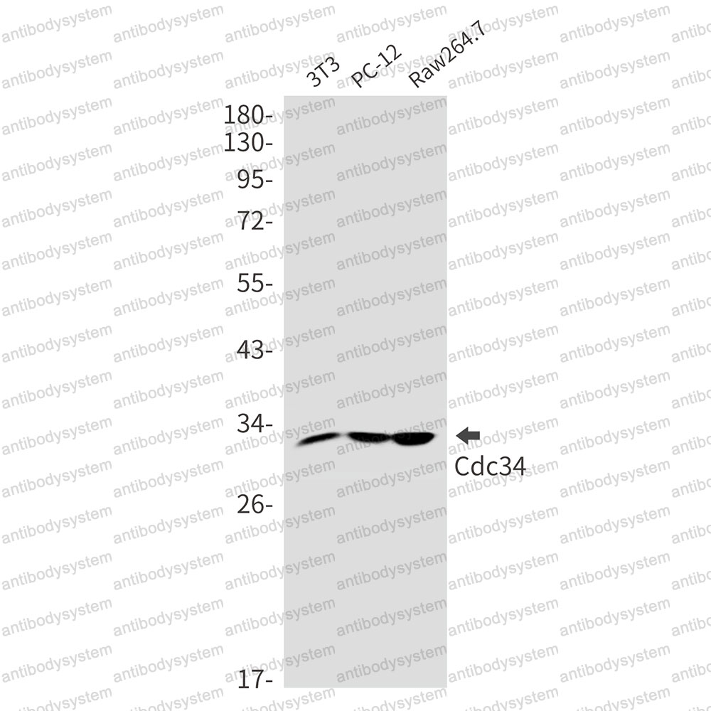 Anti-CDC34 Antibody (R1X41)