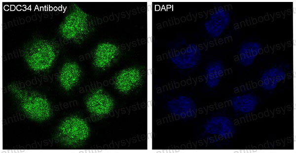 Anti-CDC34 Antibody (R1X40)