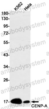 Anti-CENPA Antibody (R1X42)