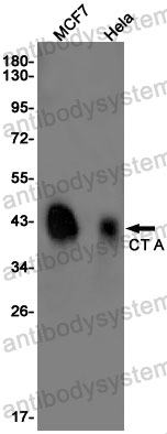 Anti-PCYT1A Antibody (R1X45)