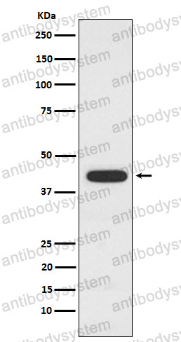 Anti-PCYT1A Antibody (R1X43)