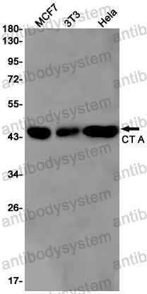 Anti-PCYT1A Antibody (R1X44)