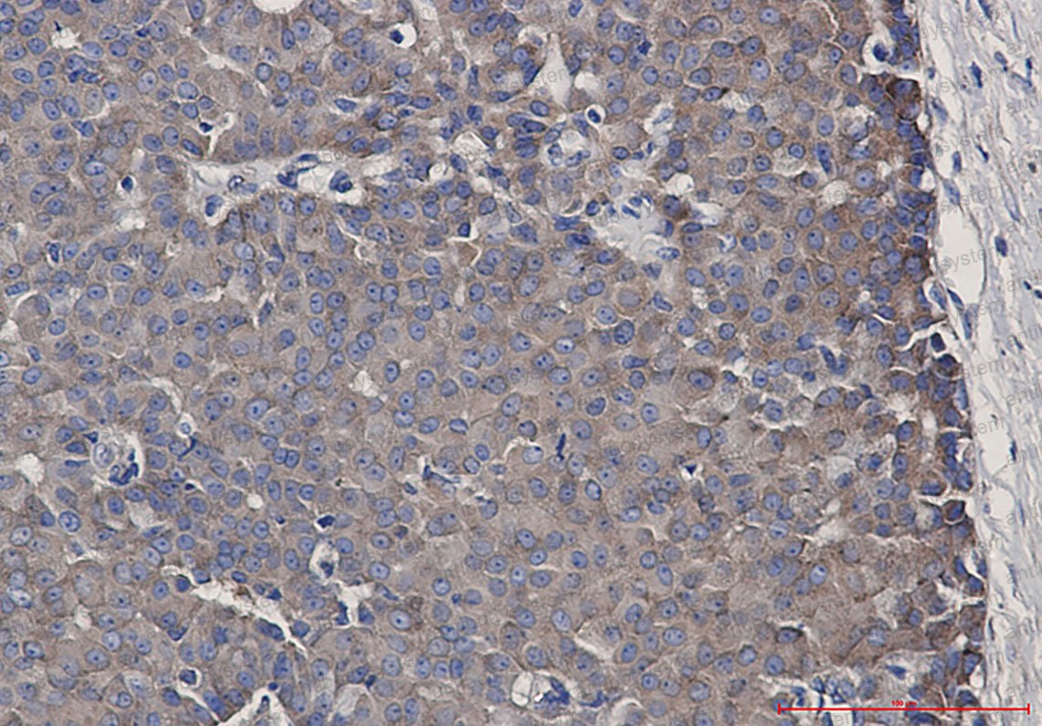 Anti-CARS1 Antibody (R1X47)
