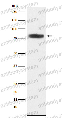 Anti-CARS1 Antibody (R1X46)
