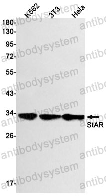 Anti-STAR Antibody (R1X50)