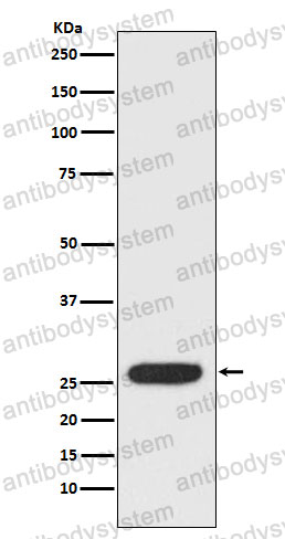 Anti-STAR Antibody (R1X49)