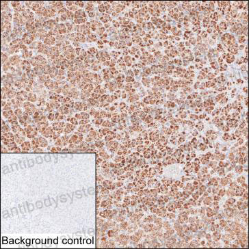 Immunohistochemical for Anti-STAR Antibody (R3L89) ?>