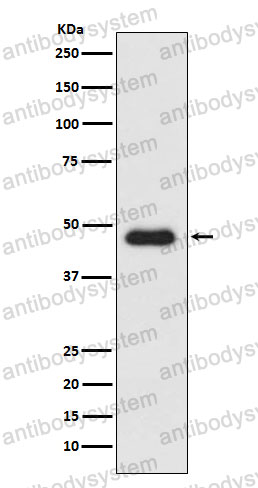 Anti-CD183/CXCR3 Antibody (R1X51)