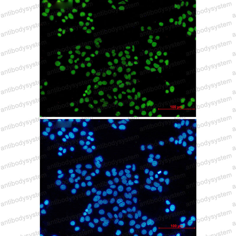Anti-MCM2 Antibody (R1X59)
