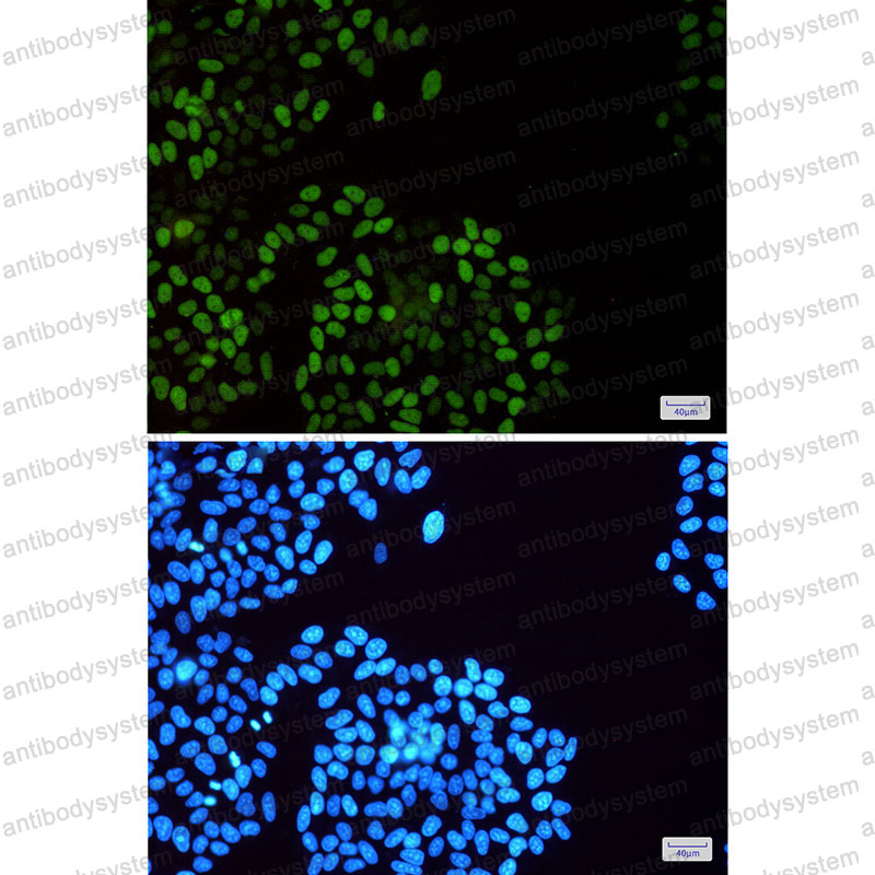 Anti-Phospho-MCM2 (Ser108) Antibody (R1X55)