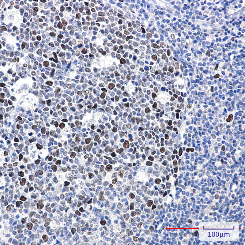 Anti-Phospho-MCM2 (Ser40) Antibody (R1X57)