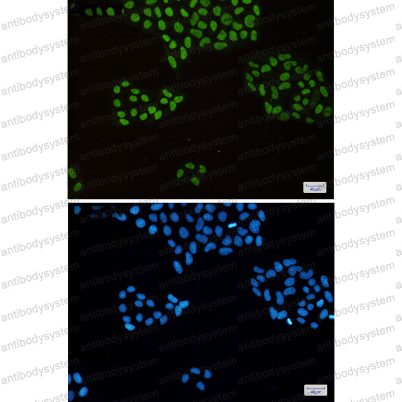 Anti-MCM2 Antibody (R1X58)