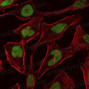 Immunofluorescence for Anti-MCM2 Antibody (R3L97) ?>