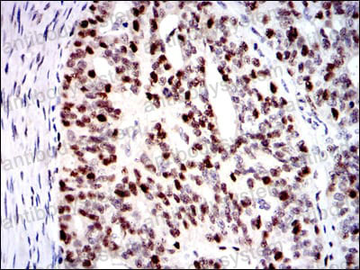 Immunohistochemical for Anti-MCM2 Antibody (R3L97) ?>