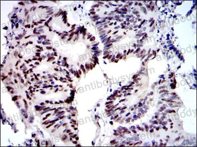 Immunohistochemical for Anti-MCM2 Antibody (R3L97) ?>
