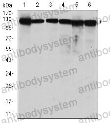 Western blot for Anti-MCM2 Antibody (R3L97) ?>