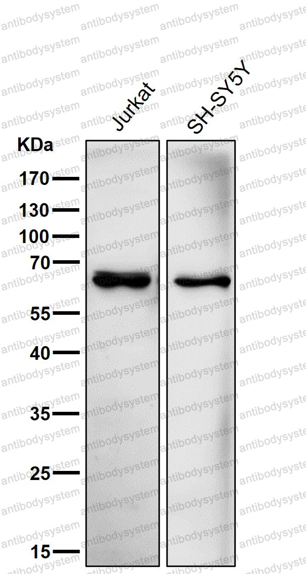 Anti-ACADVL/VLCAD Antibody (R1X60)