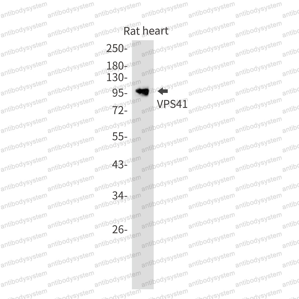 Anti-VPS41 Antibody (R1X61)