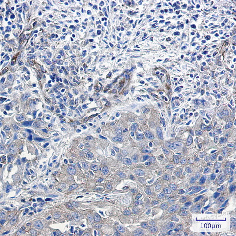 Anti-NUMB Antibody (R1X63)