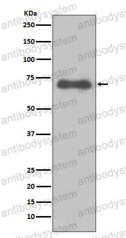 Anti-NUMB Antibody (R1X62)