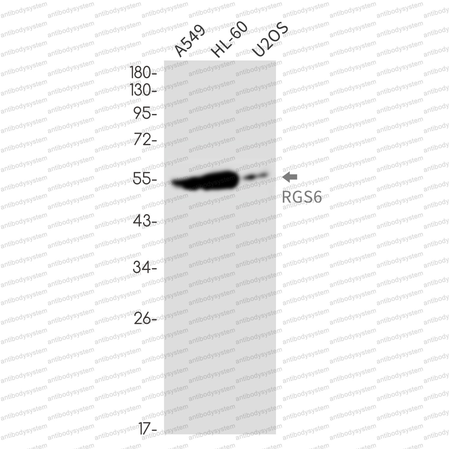 Anti-RGS6 Antibody (R1X65)