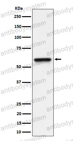Anti-RGS6 Antibody (R1X64)