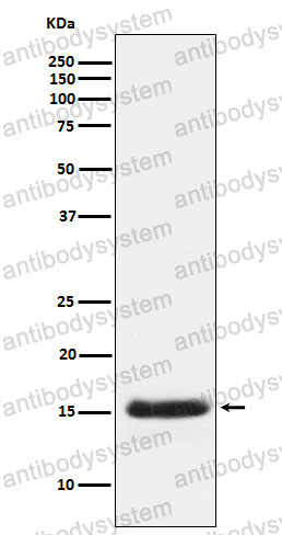 Anti-PGF/PlGF/PLGF Antibody (R1X66)