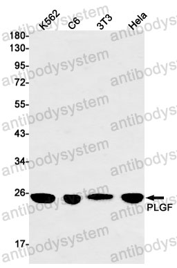Anti-PGF/PlGF/PLGF Antibody (R1X67)