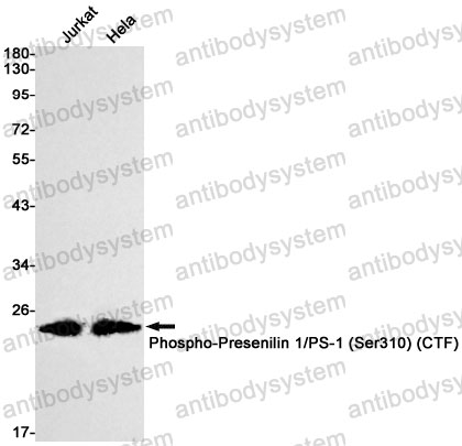 Anti-Phospho-PSEN1/Presenilin-1 (Ser310) Antibody (R1X70)