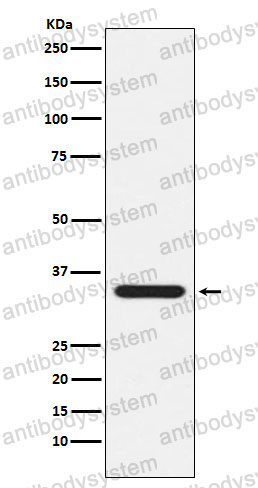 Anti-PSEN1/Presenilin-1 Antibody (R1X69)