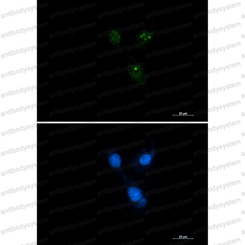 Anti-PSEN1/Presenilin-1 Antibody (R1X71)