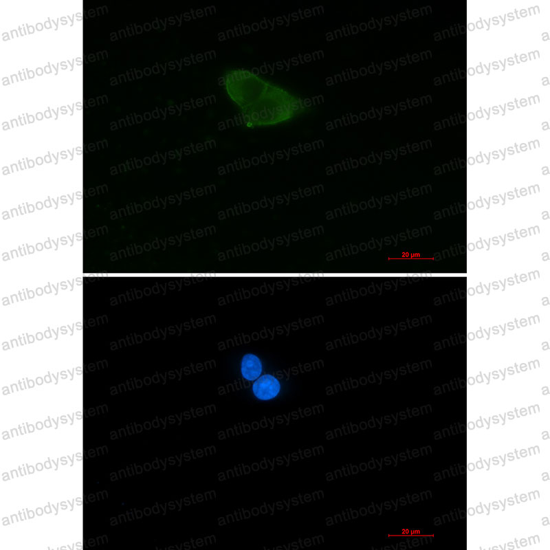 Anti-HINT1 Antibody (R1X73)