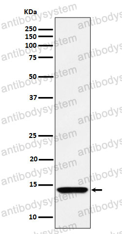 Anti-HINT1 Antibody (R1X72)