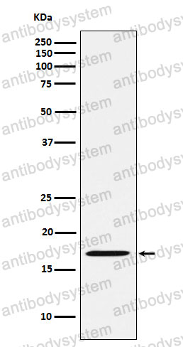 Anti-FHIT Antibody (R1X74)
