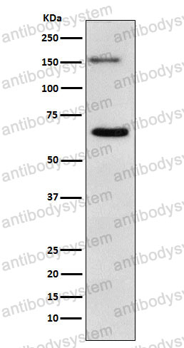 Anti-NUP153 Antibody (R1X75)