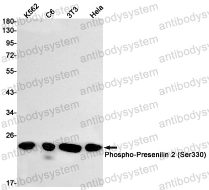 Anti-Phospho-PSEN2/Presenilin-2 (Ser330) Antibody (R1X76)